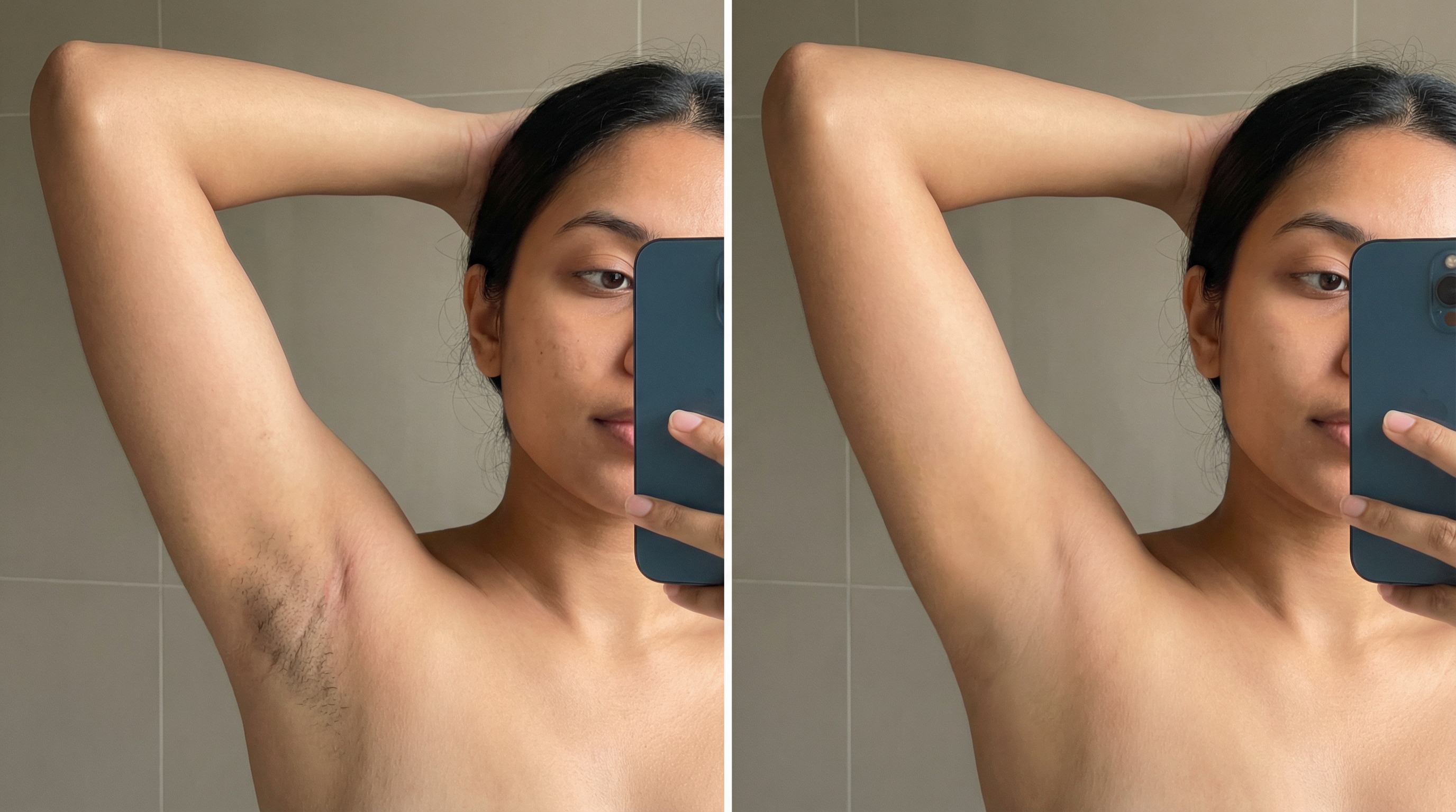 Before and After - Underarms treatment